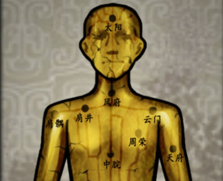 山村老屋2之废弃医院银针插穴位怎么完成？针灸详细顺序攻略[多图]