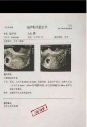怀孕单子图片制作靠谱app苹果版图片3