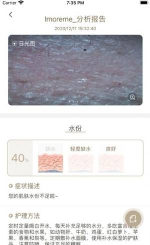 MoreMe水肤镜App手机客户端图片1